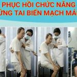 Điều Trị Phục Hồi Sau Tai Biến Mạch Máu Não? Khả Năng? Thời Gian?